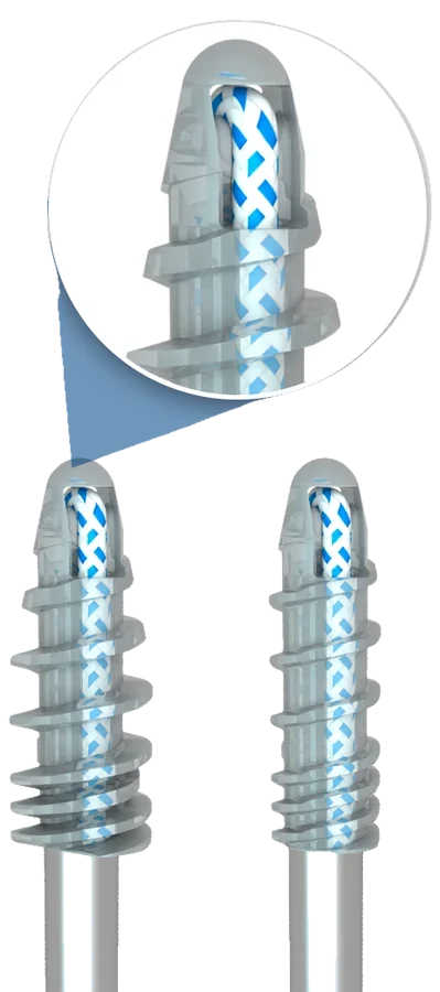 Bioanchor® — Âncoras Reabsorvíveis em PLLA