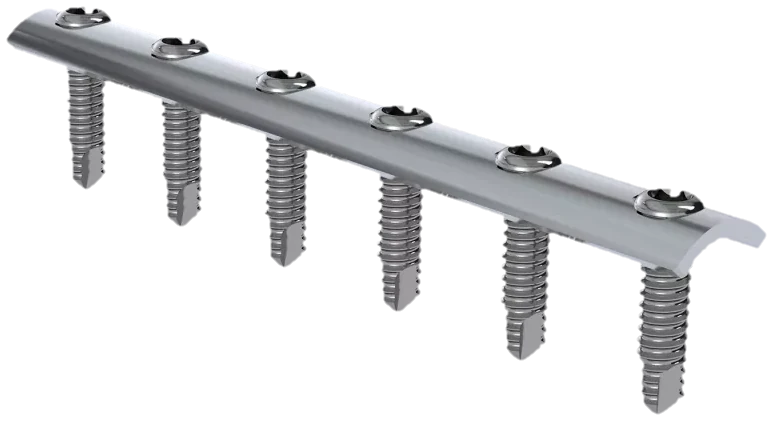 Placas Bloqueadas LPS Pequena e 1/3 Tubular