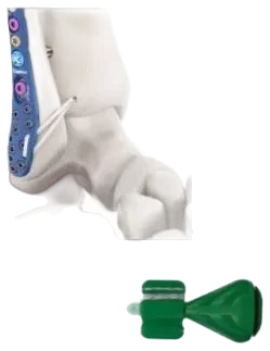 Fastlock®