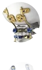 Occipitocervical e posterior