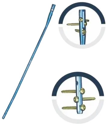 Tibiamax C®