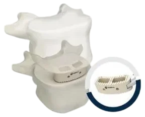 Coluna lombar